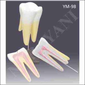 MODEL OF GIANT MOLAR