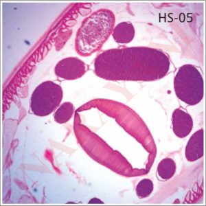 NEMATODES (ROUND WORMS)